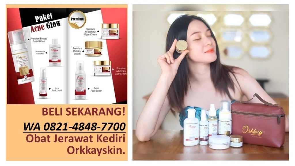 image by @orkkayskin_id