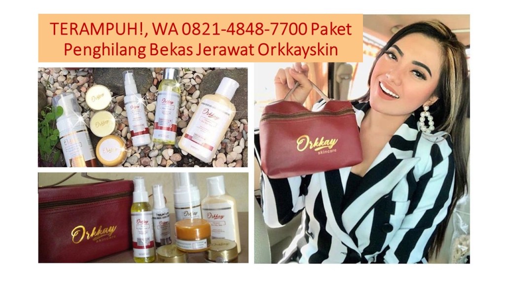 Penghilang Jerawat Batu, Penghilang Jerawat Dan Bekasnya, Penghilang Jerawat Pria, Penghilang Jerawat Punggung, Penghilang Jerawat Dan Komedo, Penghilang Jerawat Dan Bekas Jerawat, Penghilang Jerawat Acnes, Penghilang Jerawat Alami, Penghilang Jerawat Ampuh, Penghilang Jerawat Apk, Penghilang Jerawat Buat Cowok, Penghilang Jerawat Cream, Penghilang Jerawat Clean And Clear, Penghilang Jerawat Dengan Bahan Alami, Penghilang Jerawat Dan Flek